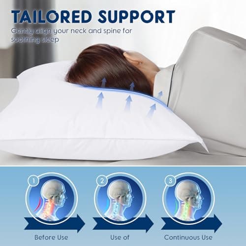 Luxury Canadian White Goose Down Pillow Queen Size - 900+ Fill Power, 800 Thread Count Cotton Shell, Soft Down Pillows for Sleeping, Hotel Pillow for Neck Pain Relief (1 Pack, 20"x30")